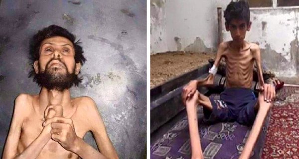   به‌ وێنه‌.. منداڵانی مه‌زایا له‌ برسان ده‌مرن